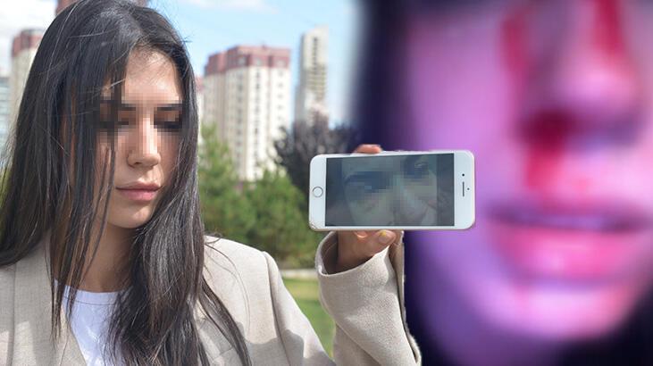 Üniversiteli Aydan’a sokak ortasında eski sevgili dehşeti!