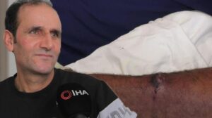 Yediği etten ‘şarbon’ bulaştı, ölümden döndü!