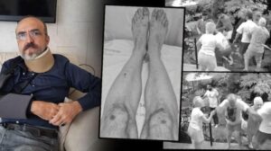 Yüksek sesle müzik dinlediği iddiasıyla villasının önünde darbedildi